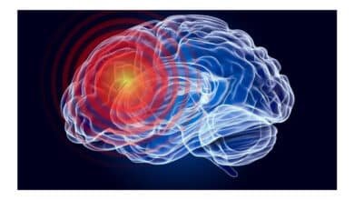 Peptídeo em estudo pode reduzir danos cerebrais após lesão