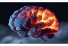 Bactéria comum da pneumonia pode estar ligada ao Alzheimer, aponta estudo