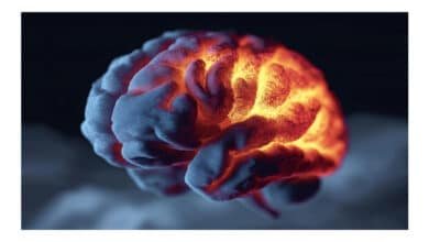 Bactéria comum da pneumonia pode estar ligada ao Alzheimer, aponta estudo