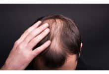 Novo estudo revela mecanismo inesperado do crescimento do cabelo humano