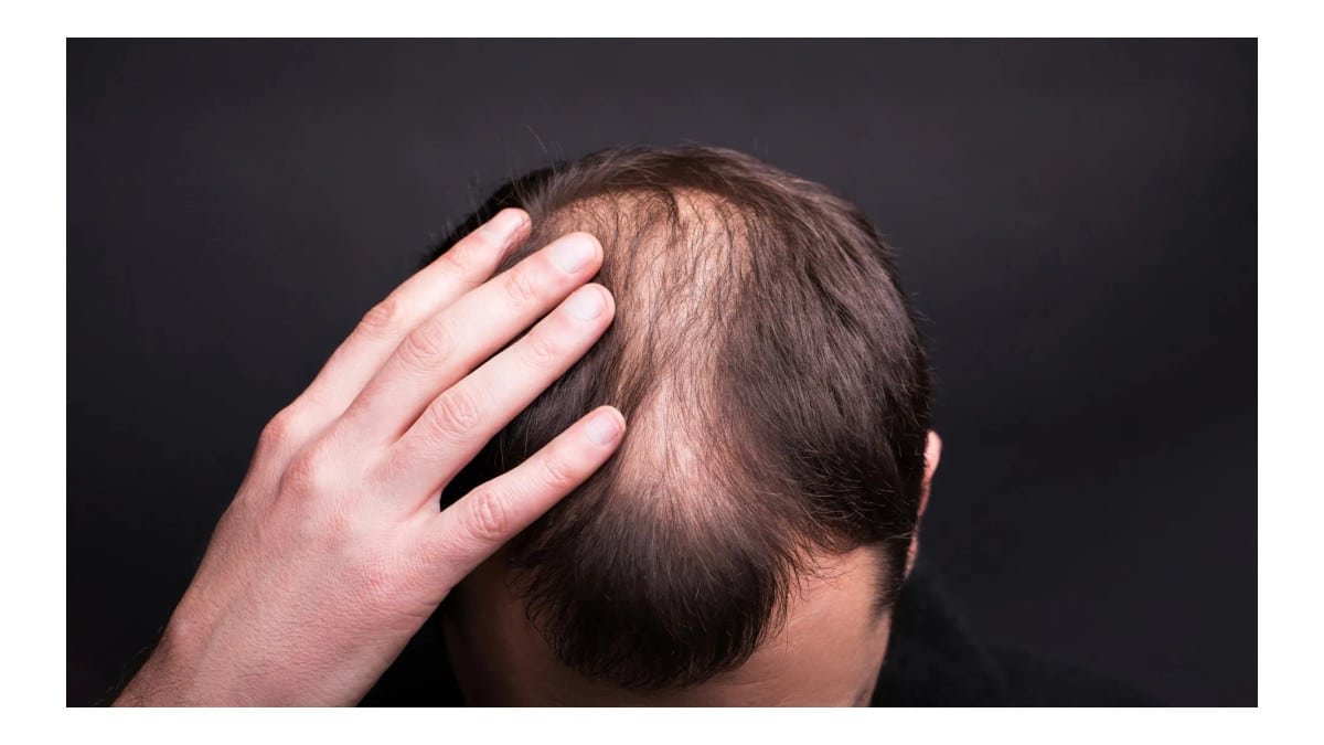 Novo estudo revela mecanismo inesperado do crescimento do cabelo humano