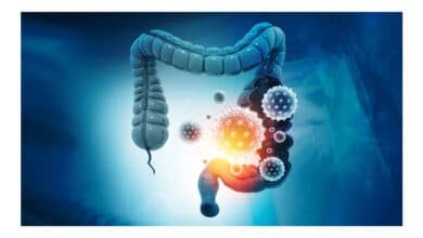 Descobertas sobre o câncer de cólon podem influenciar tratamentos futuros