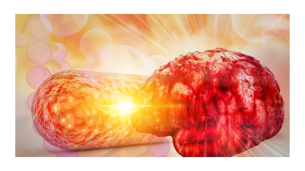 Estudo revela relação entre saúde intestinal e risco de Alzheimer